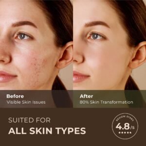 Gya Labs Australian Tea Tree Essential Oil for Skin ...